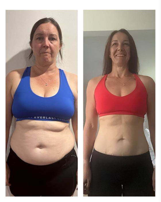 Narelle's before and after photos